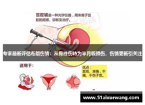 专家最新评估布朗伤情：从骨挫伤转为半月板损伤，伤情更新引关注